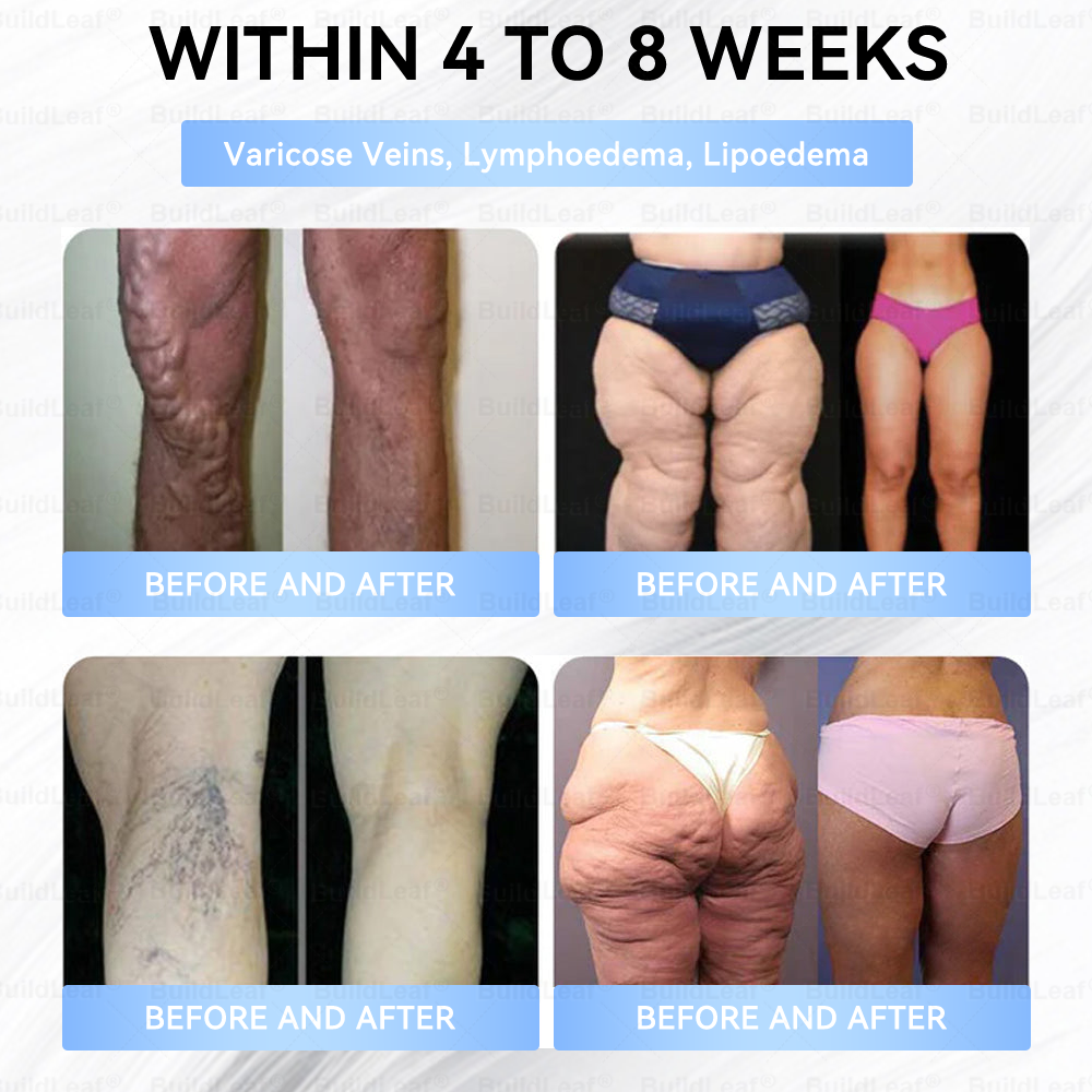 🇨🇦𝐁𝐮𝐢𝐥𝐝𝐋𝐞𝐚𝐟®Only 5 boxes left! We're offering you an additional 30% discount! Get yourself in shape and healthy. Miss out now, and you won't have another chance until next year.