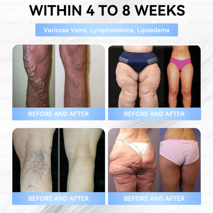 🇨🇦𝐎𝐟𝐟𝐢𝐜𝐢𝐚𝐥 𝐒𝐭𝐨𝐫𝐞·𝐁𝐮𝐢𝐥𝗱𝐋𝐞𝐚𝐟®𝐒𝐥𝐢𝐦 & 𝐅𝐢𝐫𝐦 𝐍𝐚𝐧𝐨 𝐌𝐢𝐜𝐫𝐨𝐧𝐞𝐞𝐝𝐥𝐞 𝐏𝐚𝐭𝐜𝐡 𝐰𝐢𝐭𝐡 𝐌𝐨𝐫𝐢𝐧𝐠𝐚, 𝐎𝐦𝐞𝐠𝐚-𝟑, 𝐂𝐨𝐥𝐥𝐚𝐠𝐞𝐧 𝐏𝐞𝐩𝐭𝐢𝐝𝐞𝐬, 𝐍𝐀𝐃 & 𝐍𝐌𝐍 𝐟𝐨𝐫 𝐎𝐛𝐞𝐬𝐢𝐭𝐲, 𝐂𝐚𝐫𝐝𝐢𝐨𝐯𝐚𝐬𝐜𝐮𝐥𝐚𝐫 𝐃𝐢𝐬𝐞𝐚𝐬𝐞, 𝐃𝐢𝐚𝐛𝐞𝐭𝐞𝐬, 𝐒𝐥𝐞𝐞𝐩 𝐀𝐩𝐧𝐞𝐚, 𝐉𝐨𝐢𝐧𝐭 𝐏𝐫𝐨𝐛𝐥𝐞𝐦𝐬, 𝐒𝐤𝐢𝐧 𝐅𝐢𝐫𝐦𝐢𝐧𝐠, 𝐀𝐧𝐭𝐢-𝐀𝐠𝐢𝐧𝐠, 𝐚𝐧𝐝 𝐌𝐨𝐫𝐞